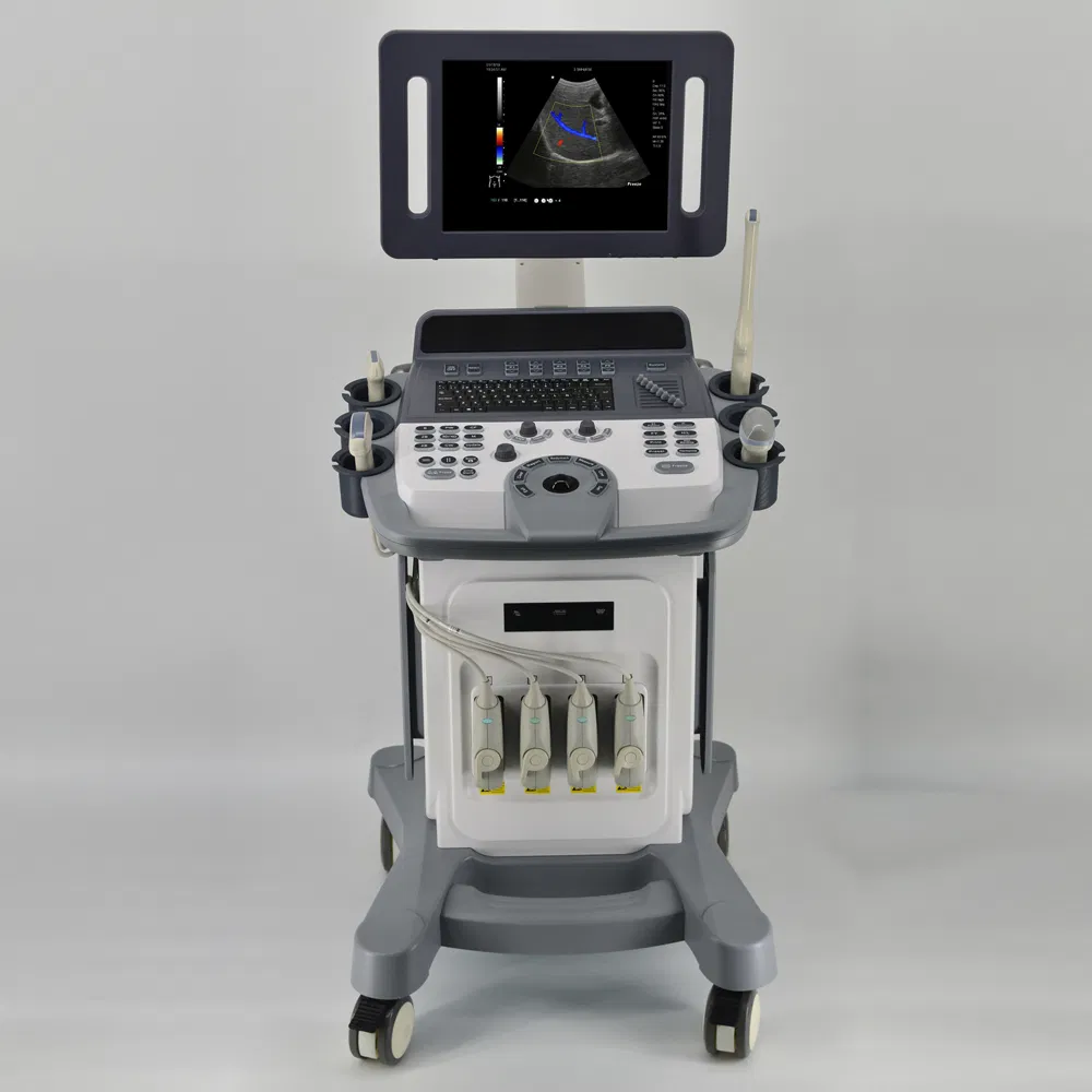 Precio de fábrica al por mayor Sistema de ultrasonido diagnóstico Doppler color Cw en varios idiomas 4D