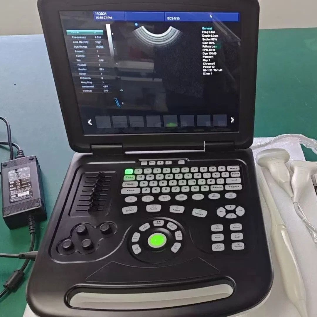 Umus067 Sistema de Ultrasonido Doppler Color Portátil-- Imágenes Avanzadas para Diagnósticos Comprensivos