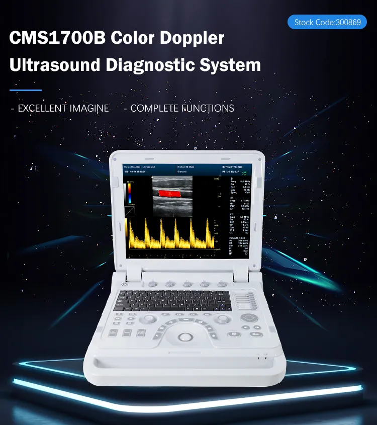 Doppler Color CMS1700B-VET