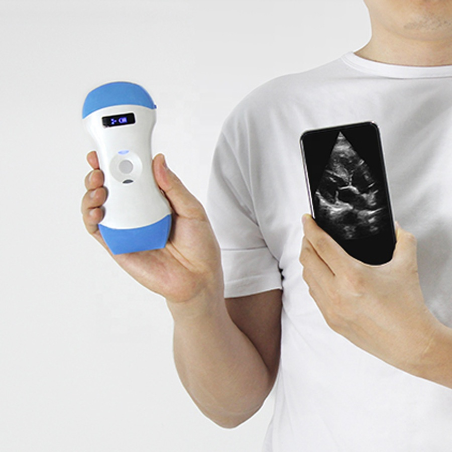 Escáner de ultrasonido portátil inalámbrico de mano con doble cabezal de color Doppler para smartphone tipo USB y WiFi