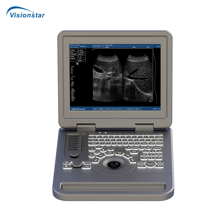 Ubm70A Equipo de Obstetricia Ginecología Verificar Máquina de Ultrasonido Portátil en Blanco y Negro