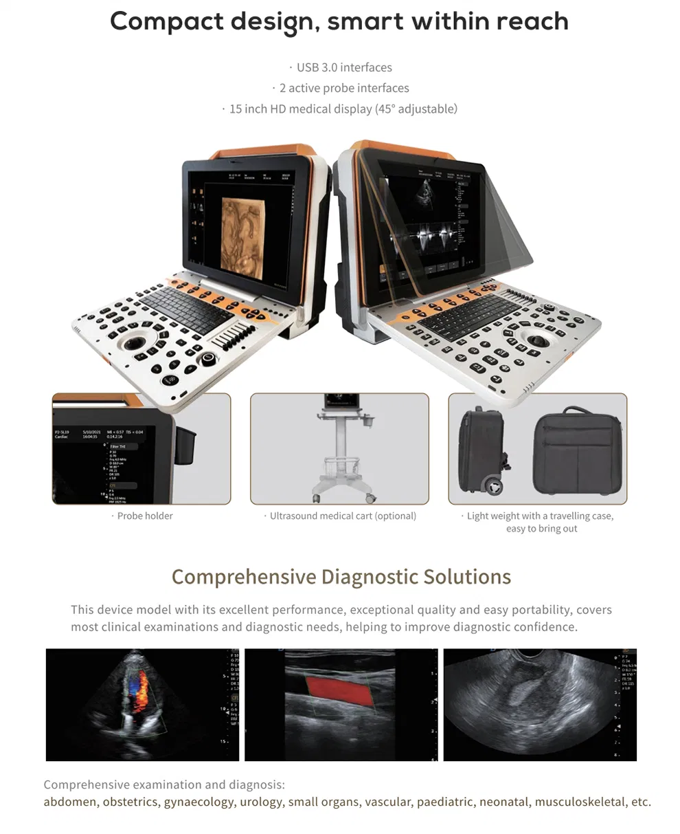 Máquina de ultrasonido diagnóstico portátil Doppler color de alta calidad