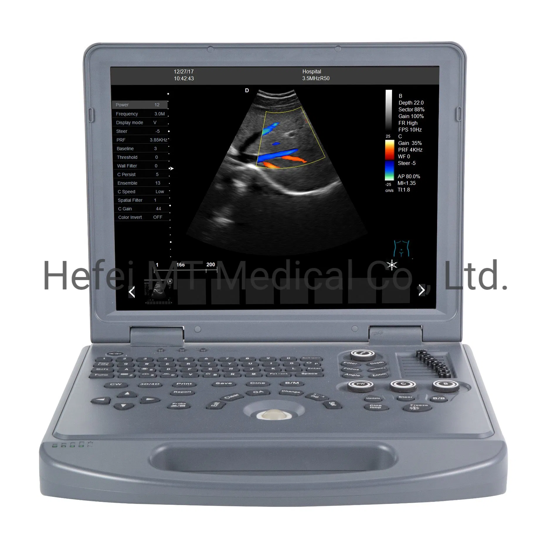 Precio de la máquina de terapia ultrasónica en blanco y negro para hospitales