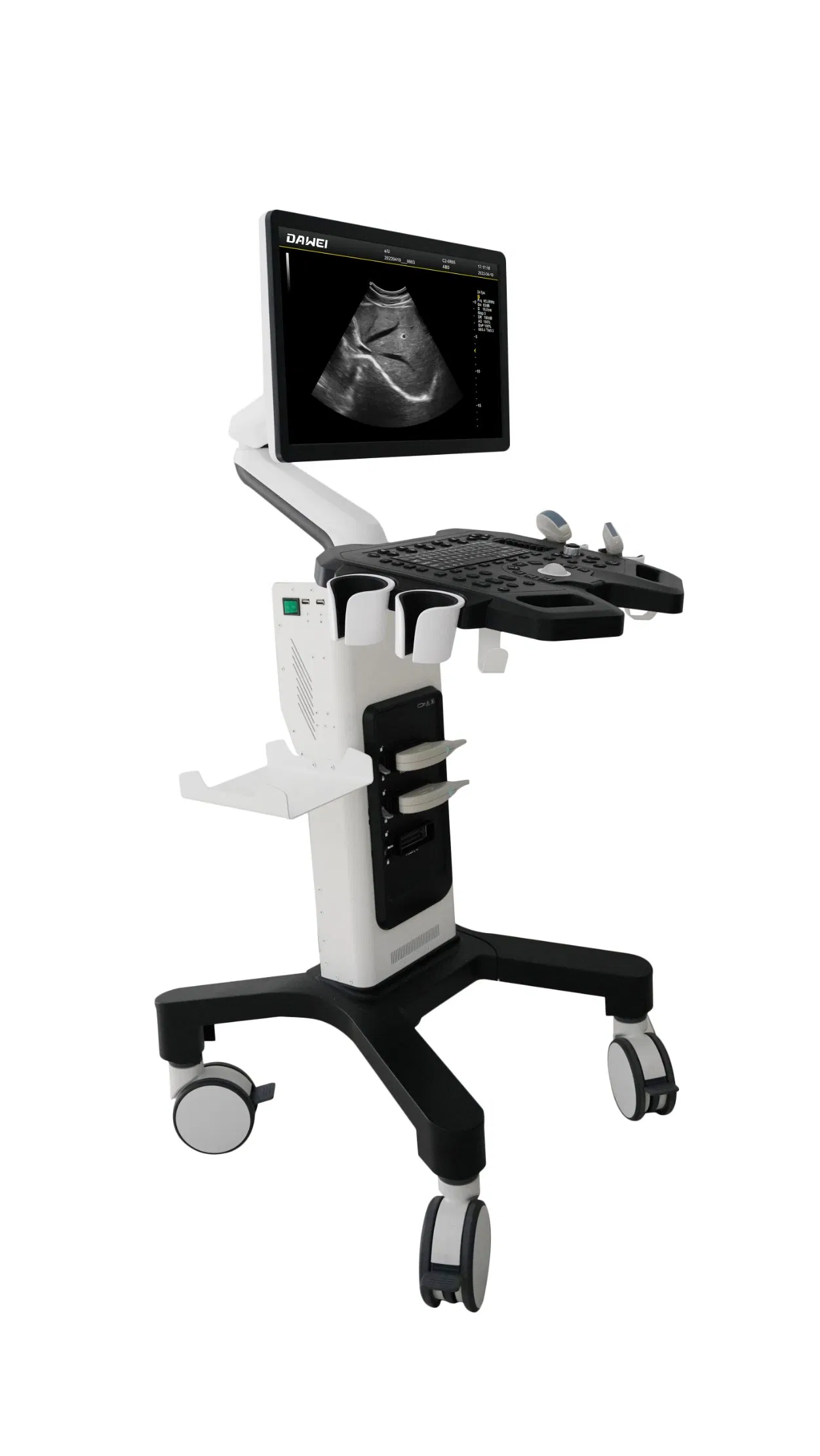 Carro médico de ultrasonido Doppler vascular