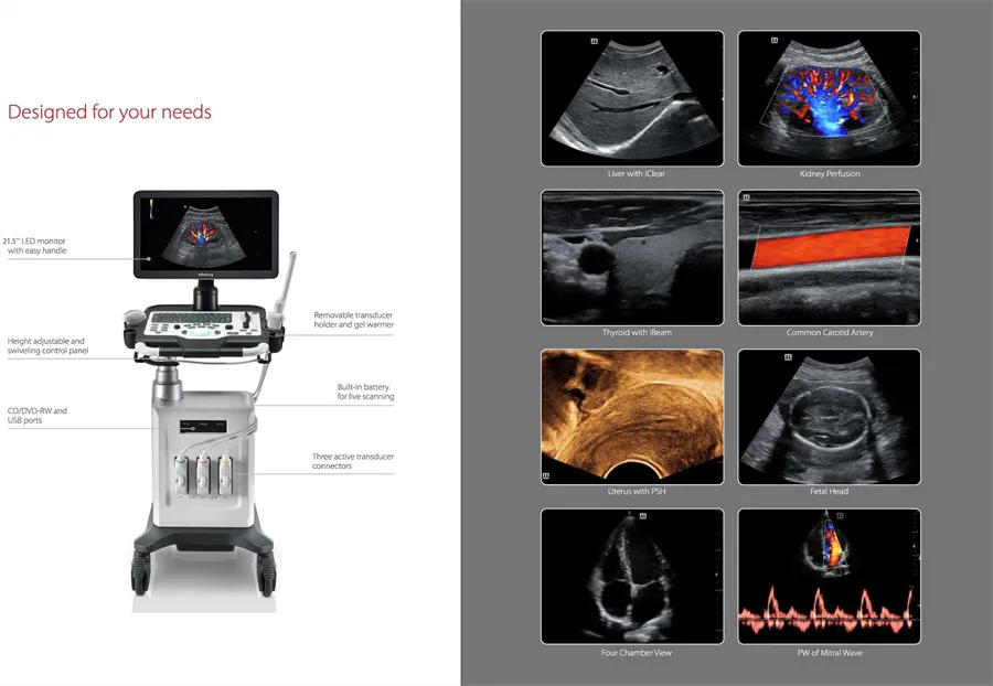 Máquina de Ultrasonido Médico Tolley