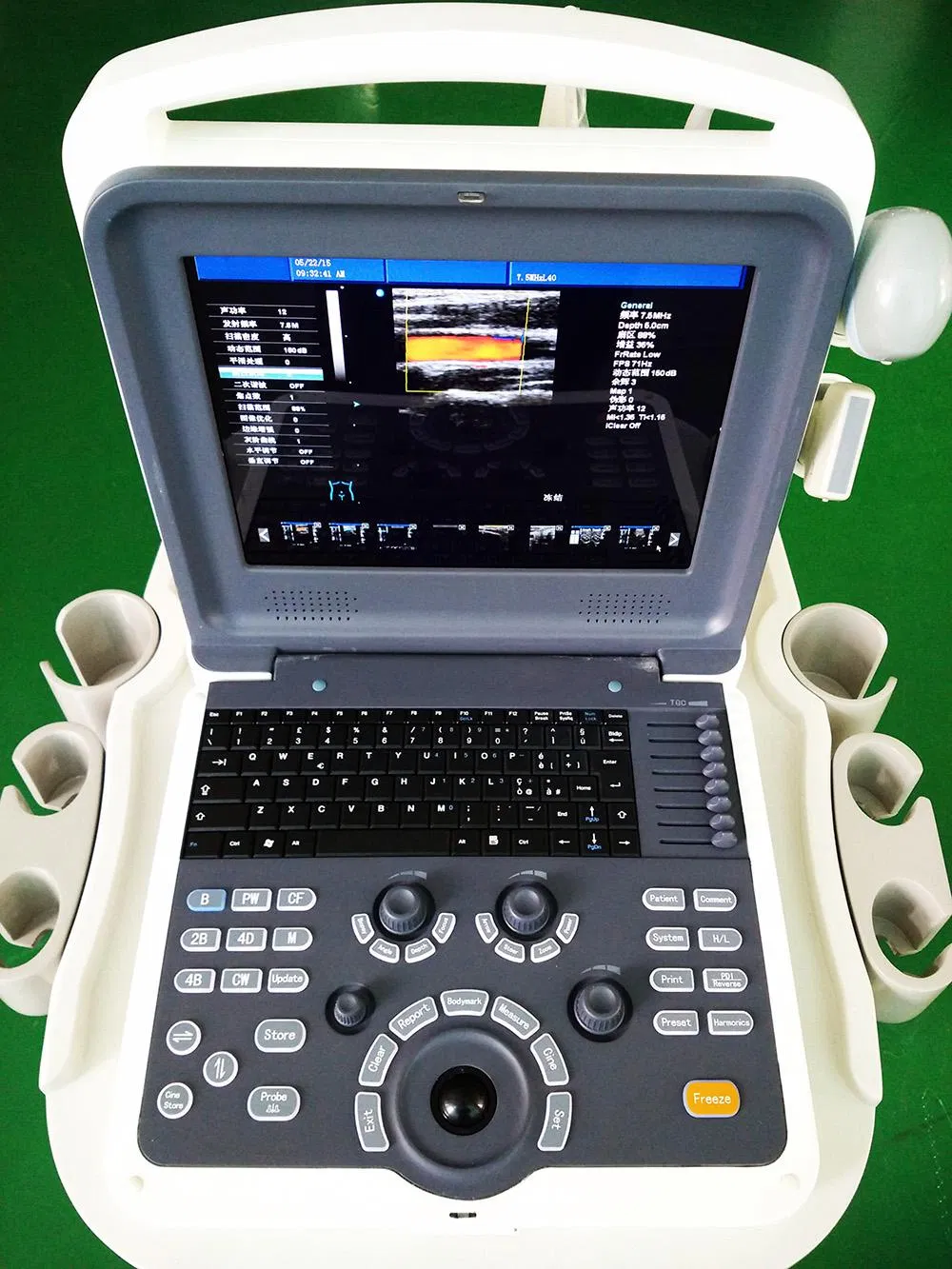 Sistema de Ultrasonido Doppler Color