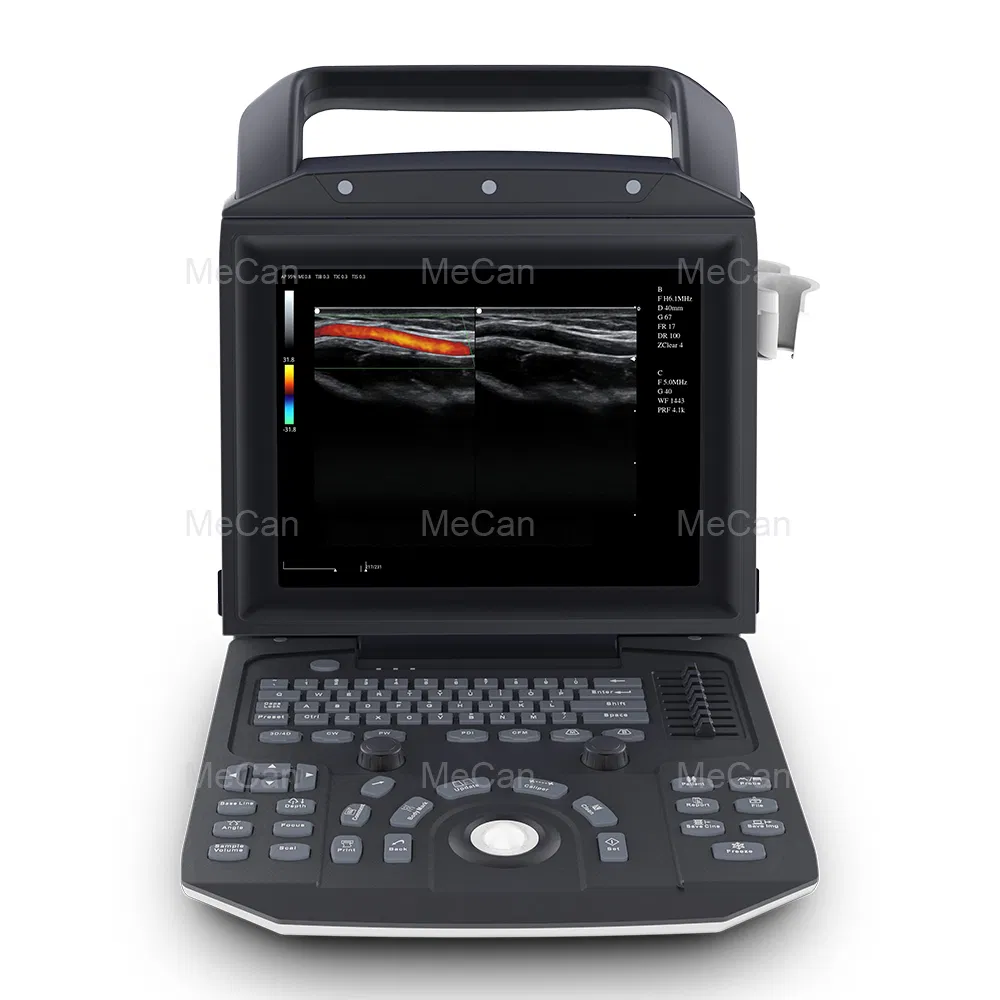 Máquina de ultrasonido cardíaco inalámbrica con pantalla táctil Doppler barata 3D portátil