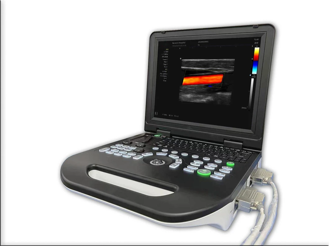 Sistema de Ultrasonido Portátil Doppler Color