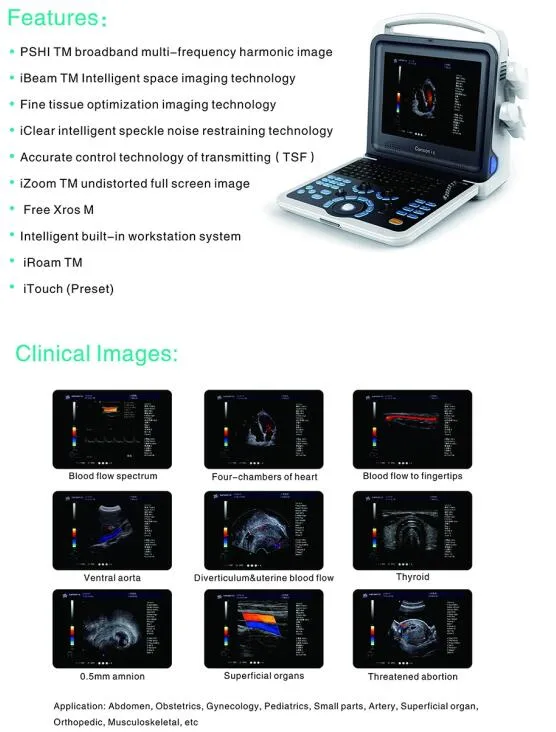 Sistema de Diagnóstico Ultrasonido Doppler Color Portátil de Clínica China 2D 4D