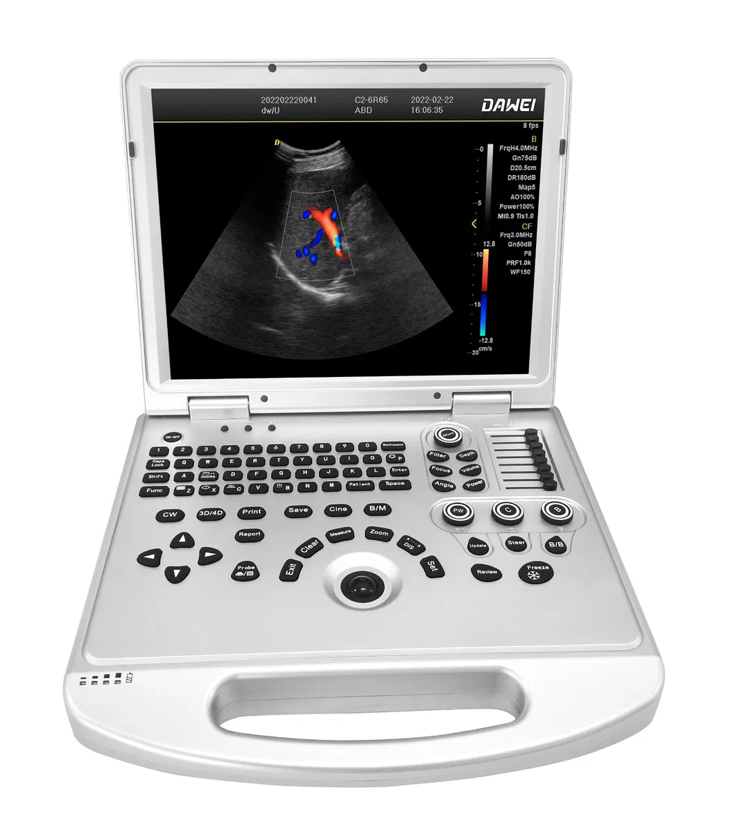 Sistema de Ultrasonido Doppler Color Portátil Dw-L3
