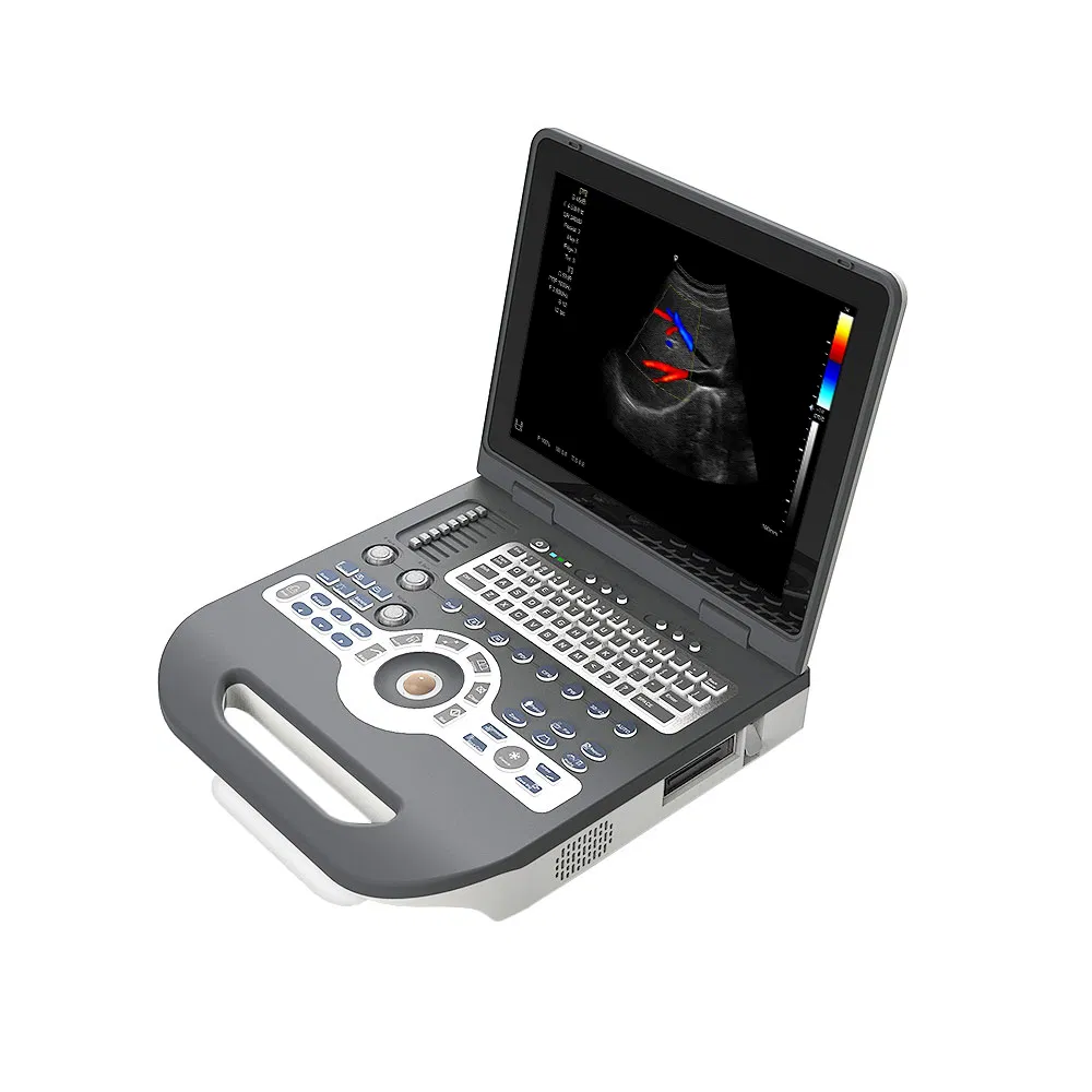 Ltub65 Económico 3D/4D Sistema de Ultrasonido Doppler Color Portátil
