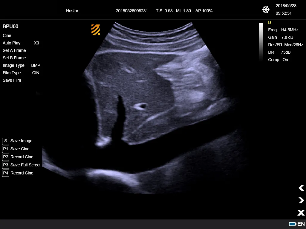 Ultrasonido Doppler Color 12