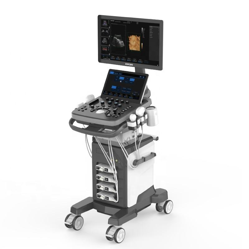 Sistema de ultrasonido Doppler color de alto rendimiento para diagnósticos precisos