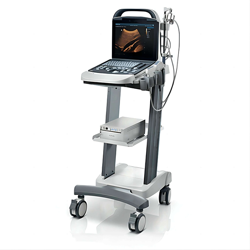 Mindray Portátil Dp30 Alta Resolución Compacto Color Doppler Eficiente Doppler Innovador Ultrasonido para Profesional Médico