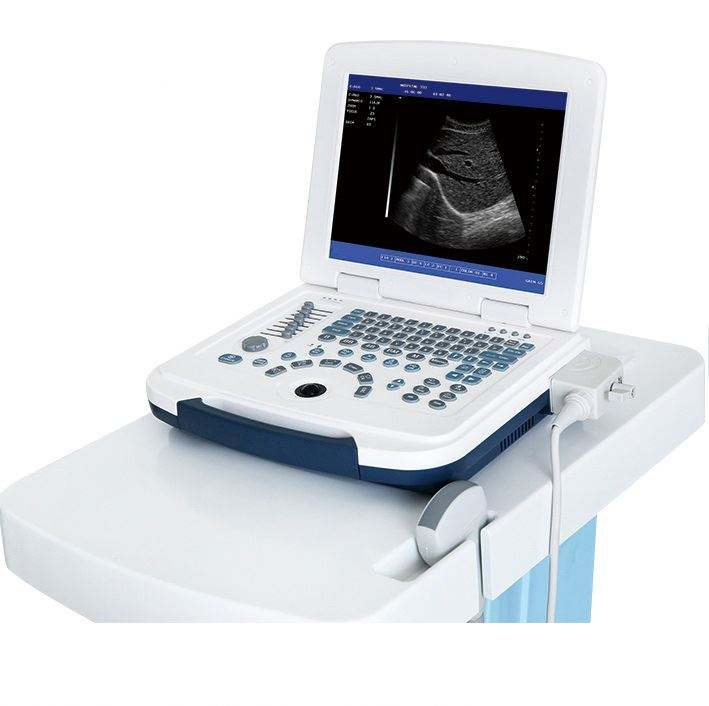 Escáner ultrasónico diagnóstico portátil humano obstétrico ginecológico barato para laptop