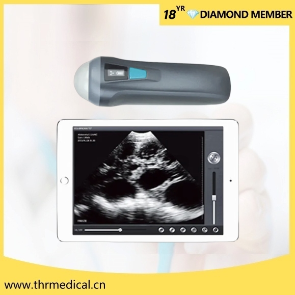 Escáner ultrasónico portátil inalámbrico mini (THR-CDC1)