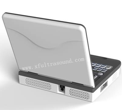 3D Escáner de ultrasonido Doppler color portátil Máquina de ultrasonido
