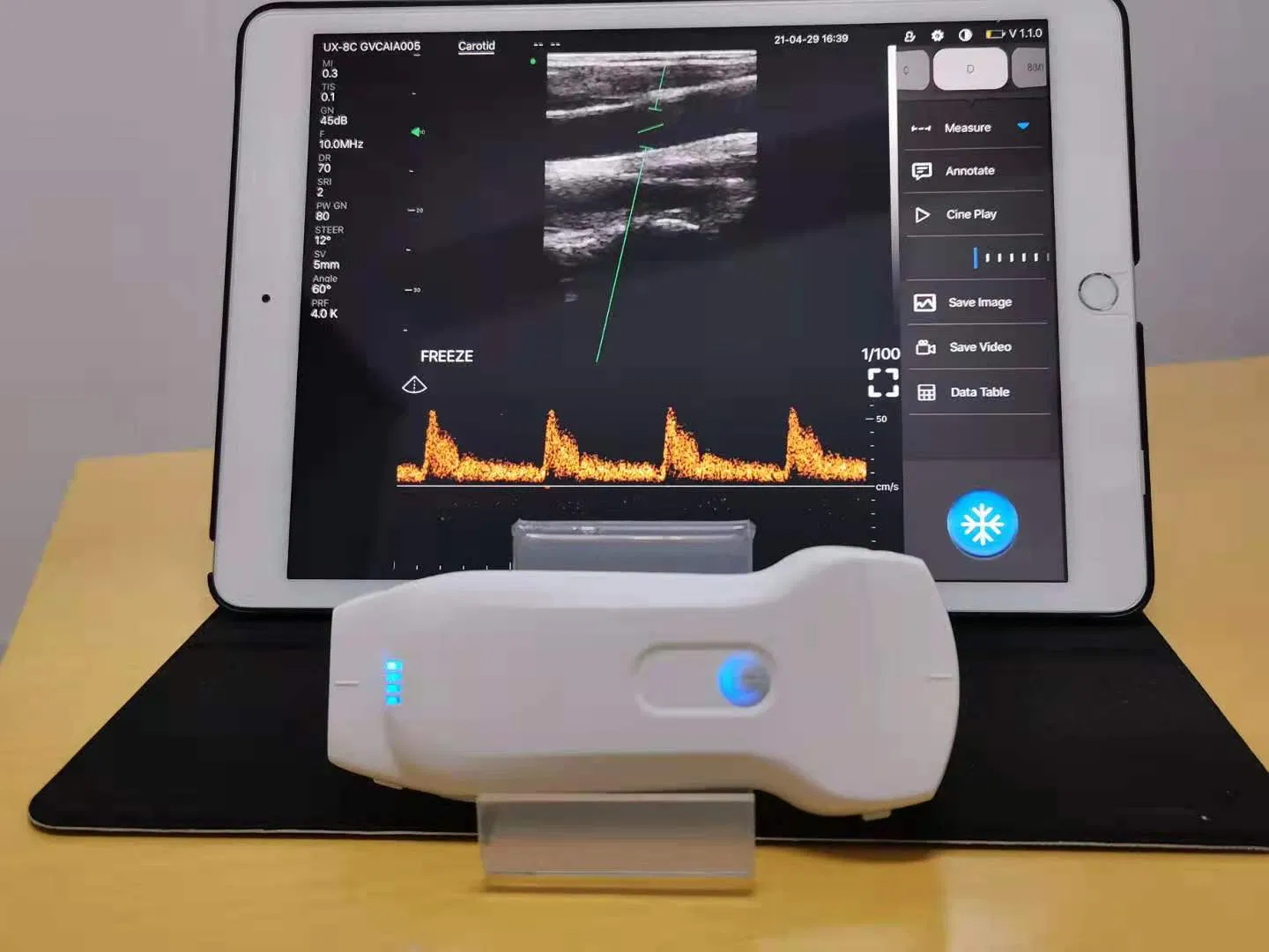 Escáner de ultrasonido Doppler color inalámbrico lineal convexo de doble sonda cardíaca