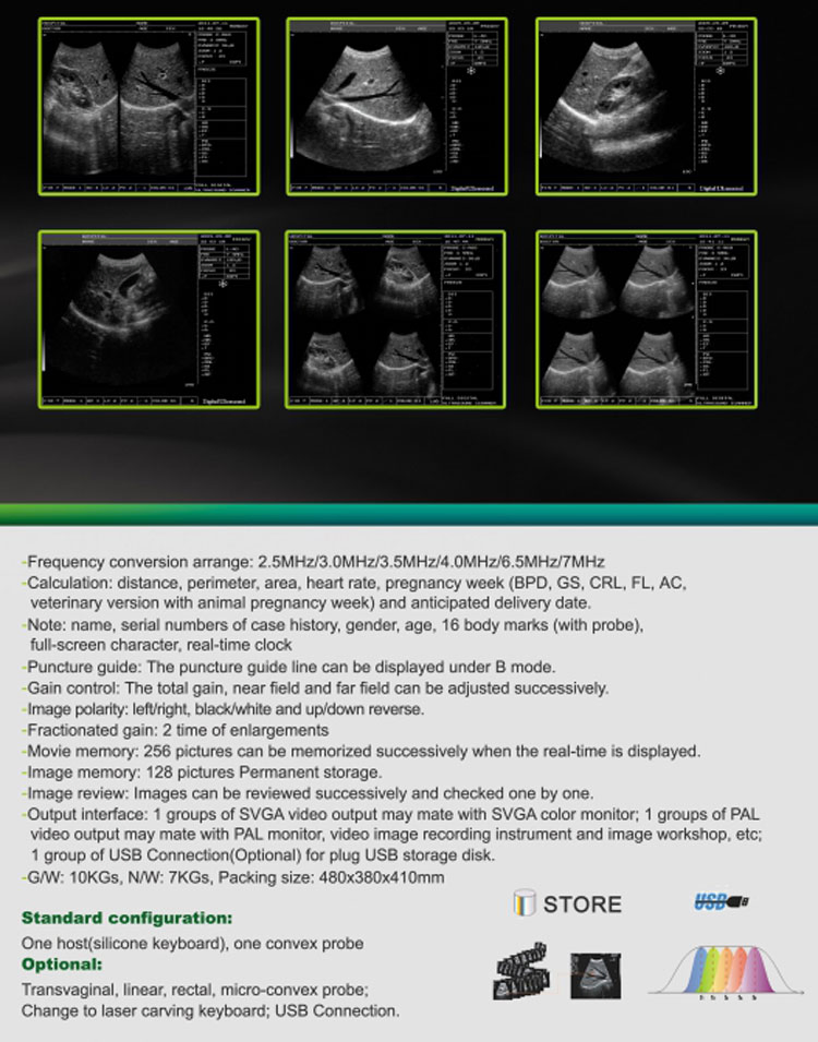 My-A001A Equipo de diagnóstico médico barato máquina de ultrasonido portátil