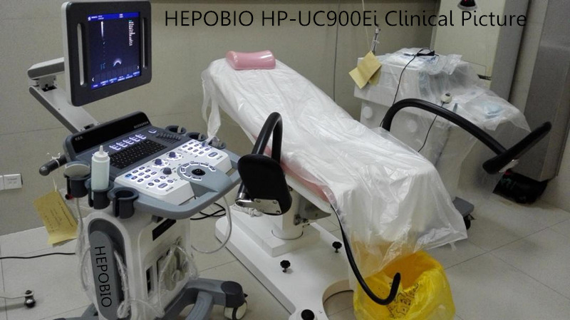 Equipo de Diagnóstico Médico Digital 4D Sistema de Ultrasonido