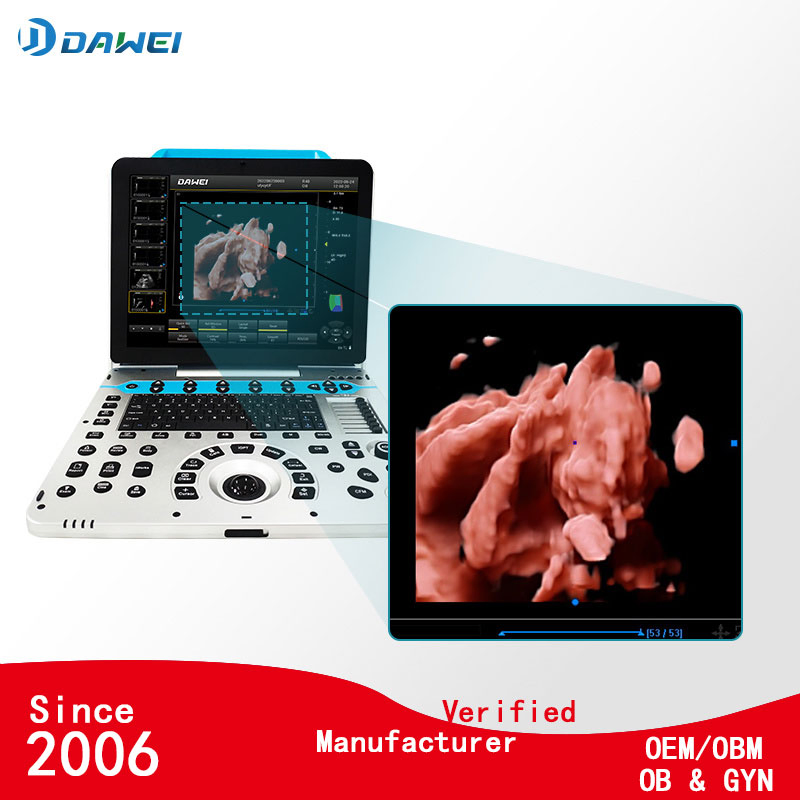 Máquina de ultrasonido Doppler color portátil de obstetricia de fábrica de China con bajo precio 3D/4D/5D