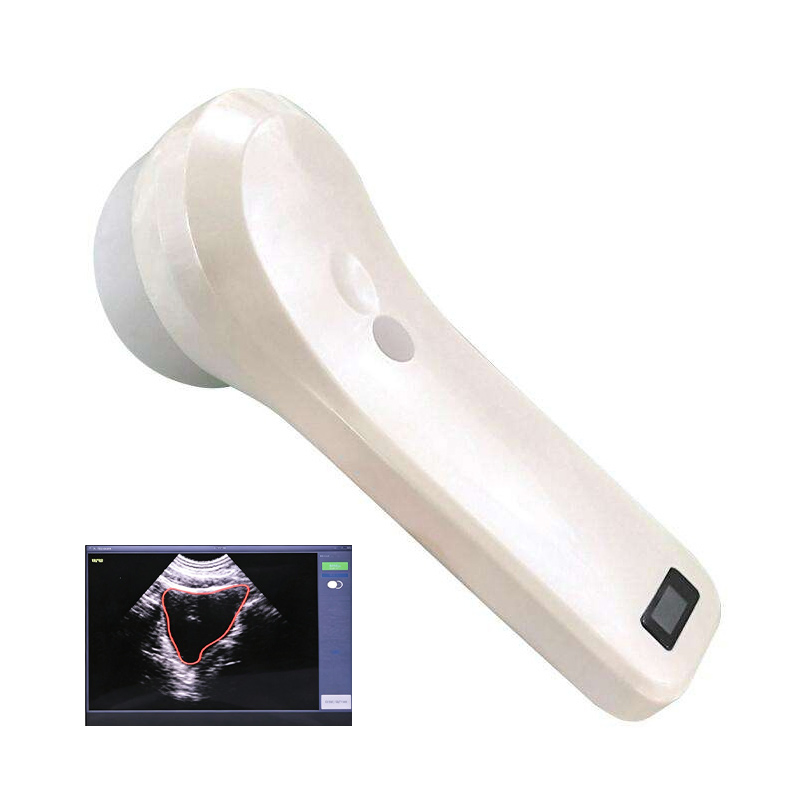 Bprobe-2 Equipos de ultrasonido China 4D Escáner de ultrasonido de vejiga inalámbrico