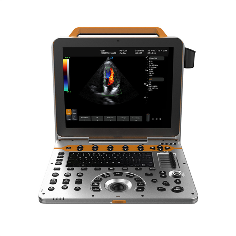 Máquina de ultrasonido diagnóstico portátil Doppler color de alta calidad de China