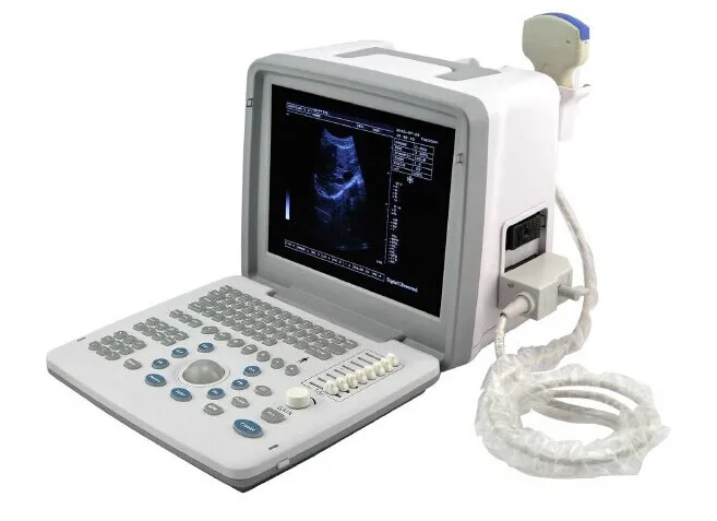 UBW300 Vista 1