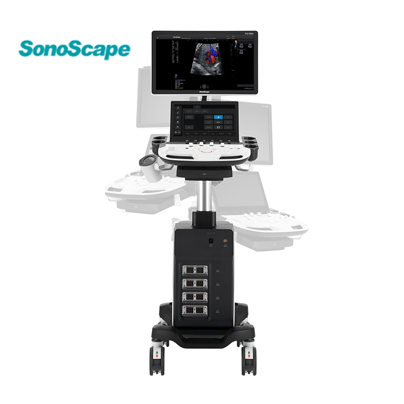 Sonoscape P11 Instrumentos de ultrasonido médico baratos Máquina de ultrasonido en blanco y negro Ecógrafo portátil Escáner de ultrasonido