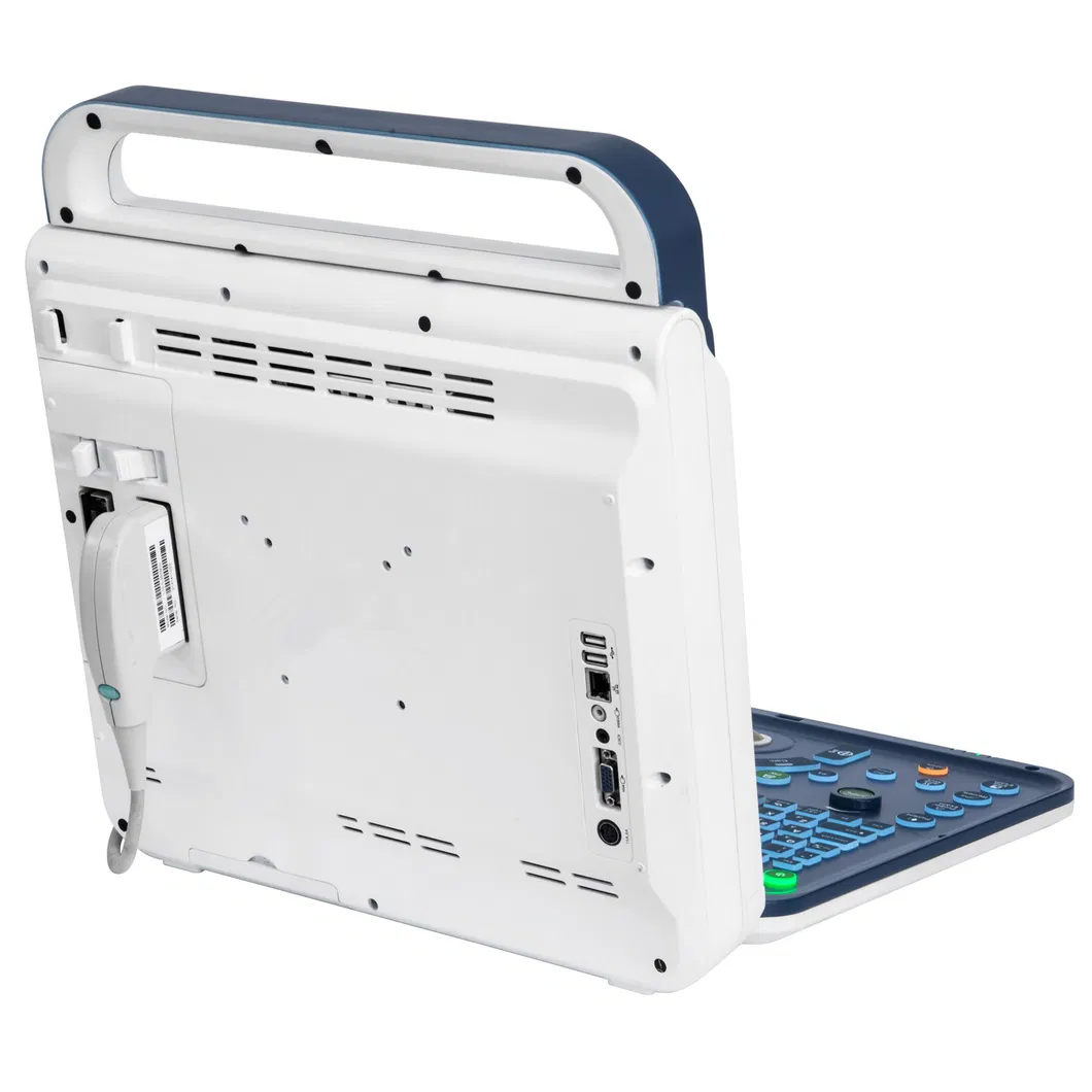 Ultrasonido Doppler Color 4