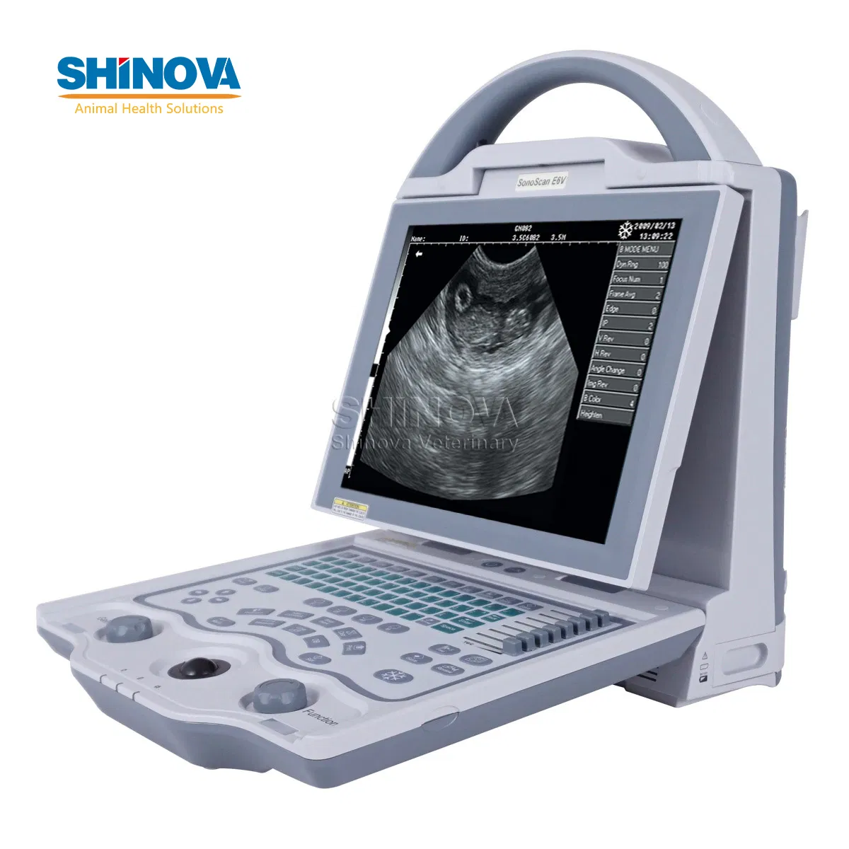 Sistema de Ultrasonido Digital Portátil Completo (SonoScan E6V)