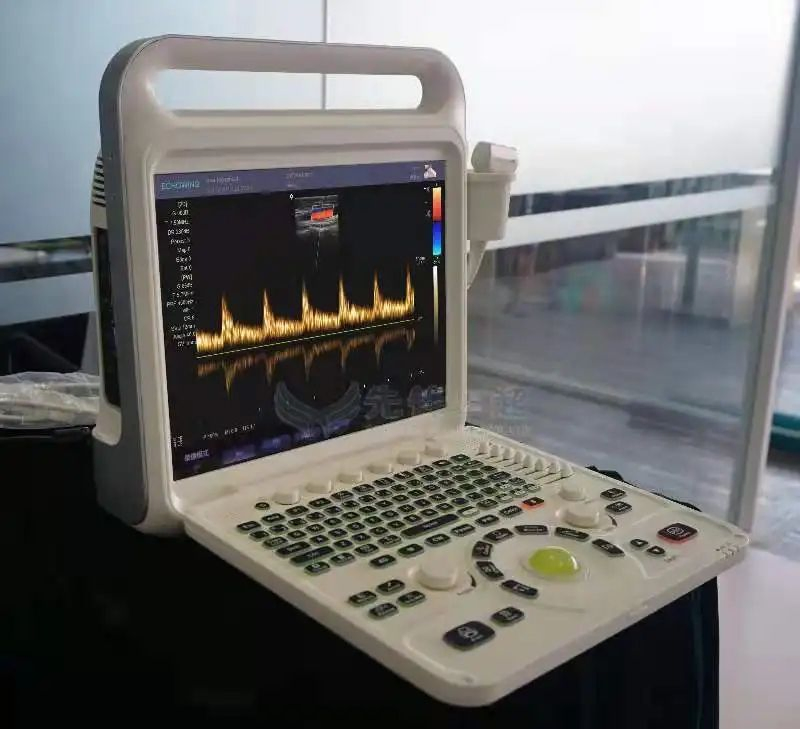 Sistema de ultrasonido avanzado de imagen por flujo de color digital con sonda convexa y imagen Doppler
