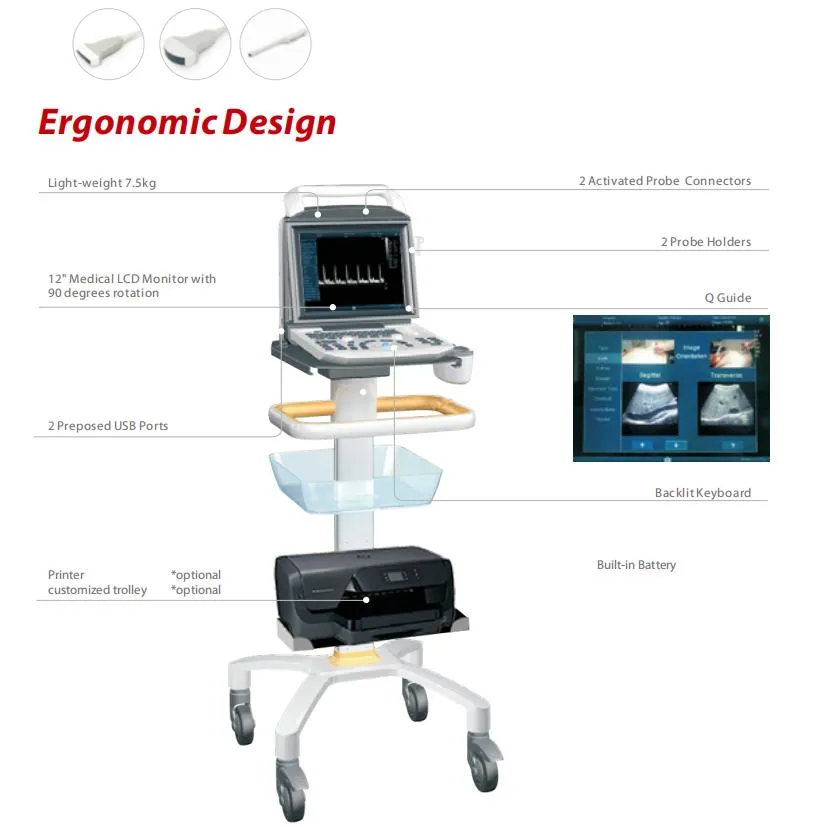 Máquina de ultrasonido blanco y negro
