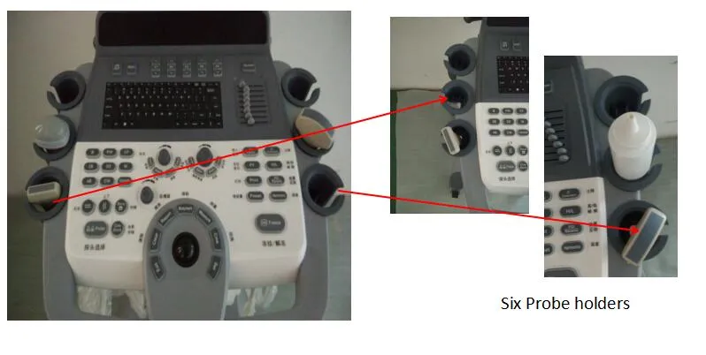 Sistema de Ultrasonido Digital