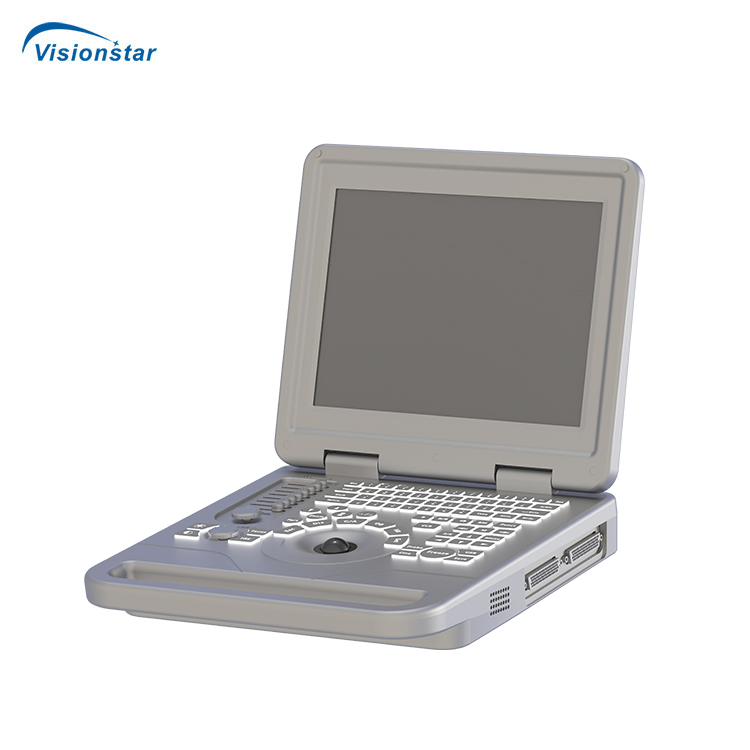 Ubm70A Equipo de Obstetricia Ginecología Verificar Máquina de Ultrasonido Portátil en Blanco y Negro
