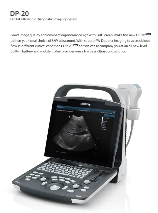 Mindray DP30 Vista Lateral