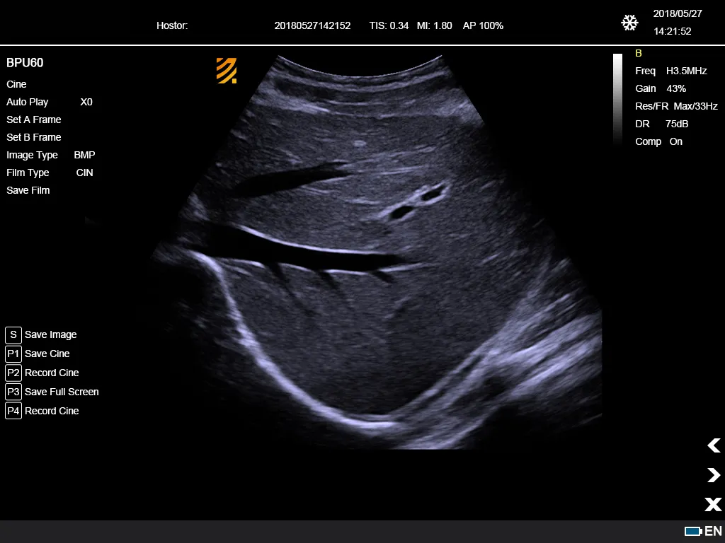 Ultrasonido Doppler Color 11