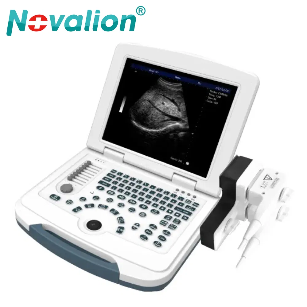 Precio de fábrica al por mayor Nl060701004A 12.1 Pulgadas Pantalla Médica 2D Máquina de Ultrasonido Portátil en Blanco y Negro