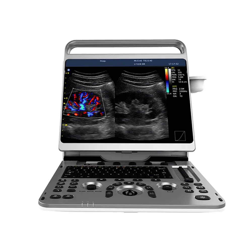 Máquina de Ultrasonido Diagnóstico Portátil Ebit50 3D 4D Sistema Doppler Color con C3-E Máquina de Diagnóstico Sistema Doppler