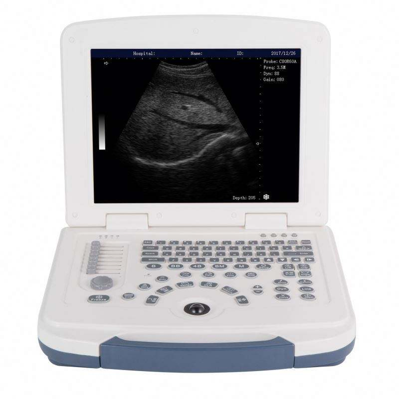 Escáner ultrasónico diagnóstico portátil humano obstétrico ginecológico barato para laptop