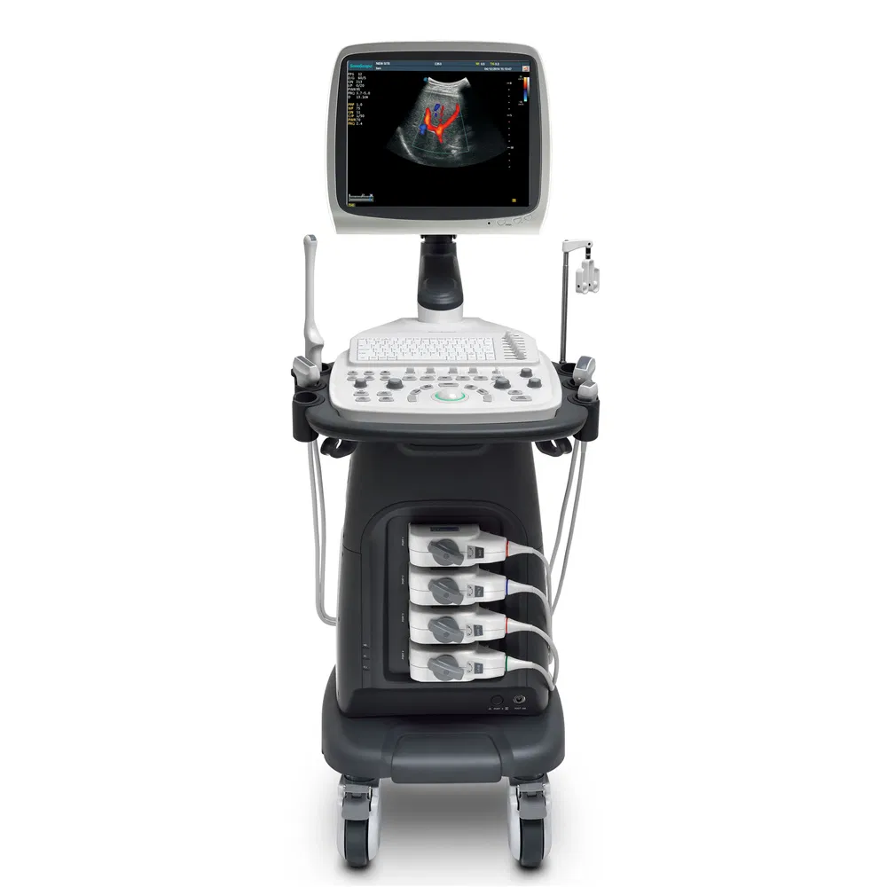 S12 Móvil Médico 3D/4D Máquina de Ultrasonido Doppler Color