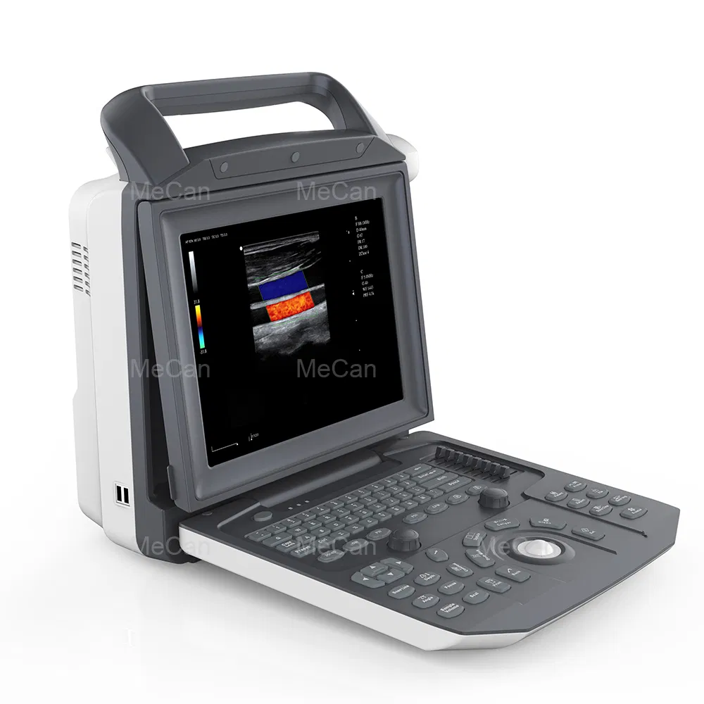 Máquina de ultrasonido cardíaco inalámbrica con pantalla táctil Doppler barata 3D portátil
