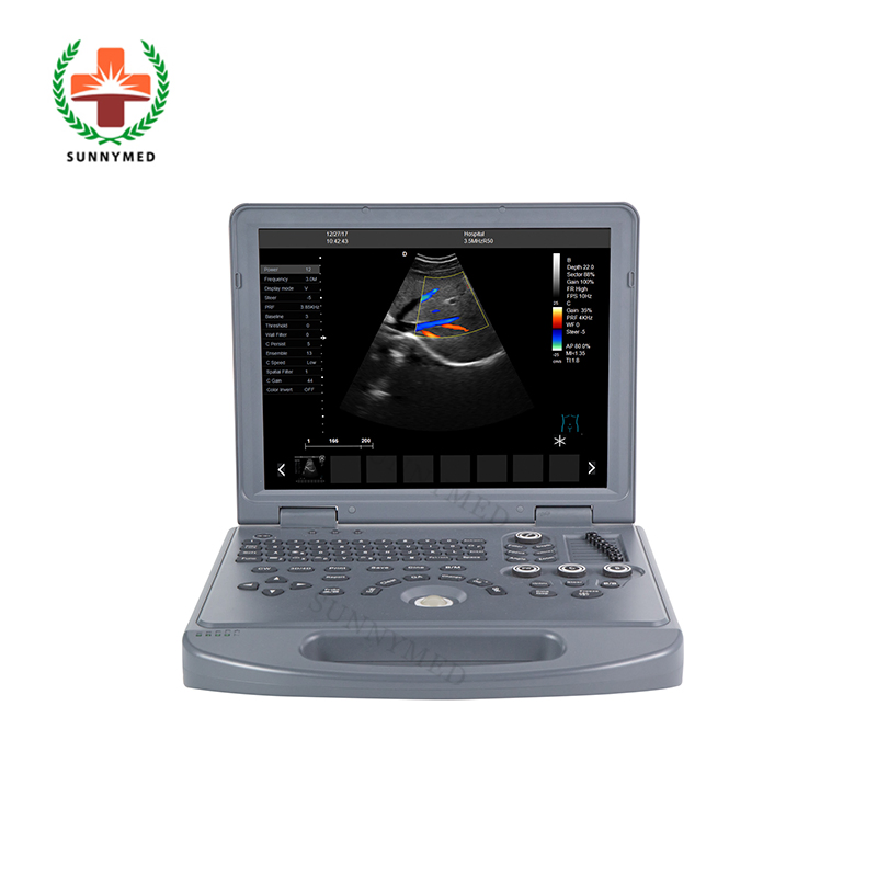 Sy-A024A Máquina de ultrasonido Doppler color para ginecología, obstetricia y vascular en venta