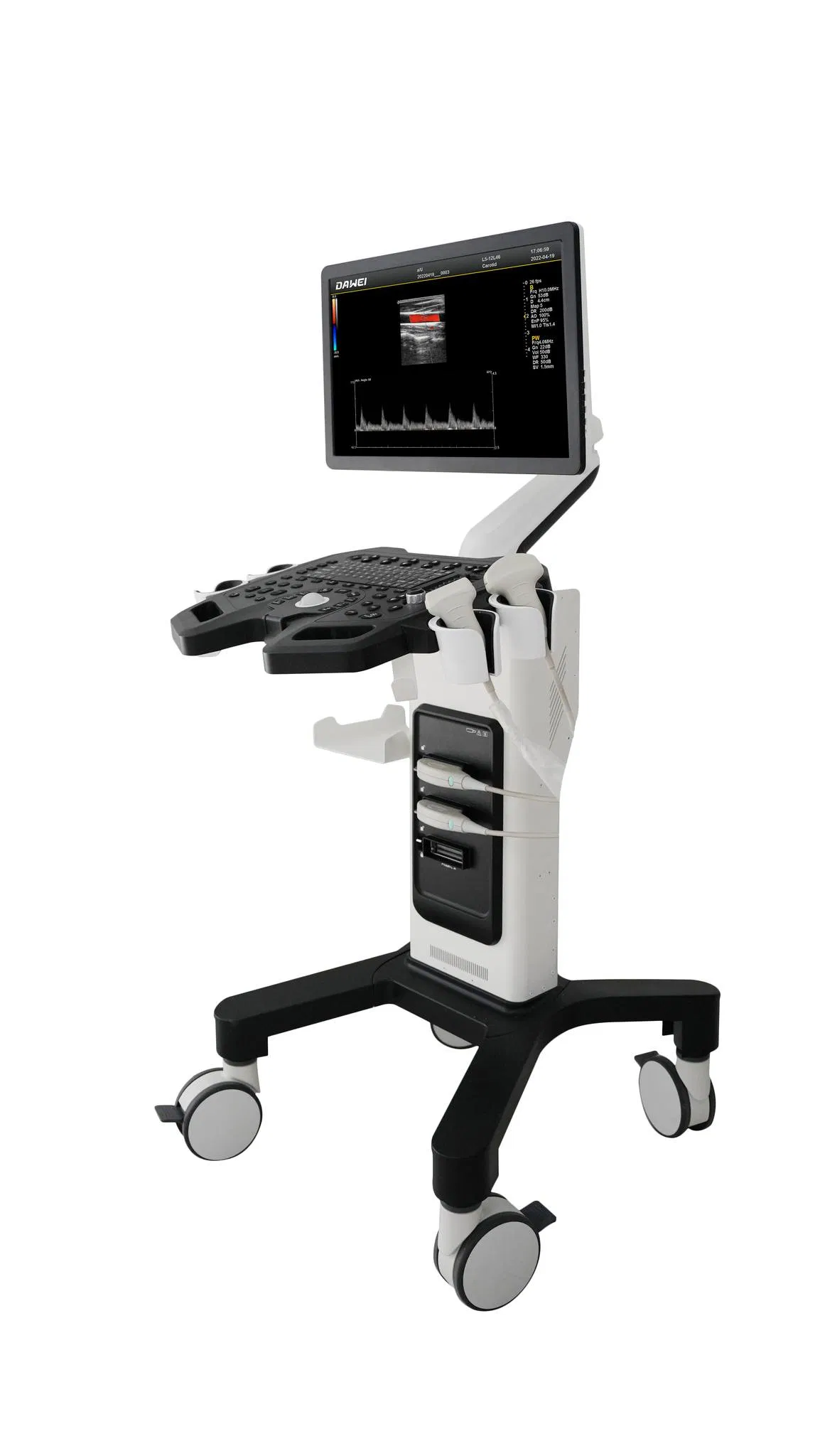 Dw-F3 Sistema de ultrasonido Doppler color montado en carro básico y asequible