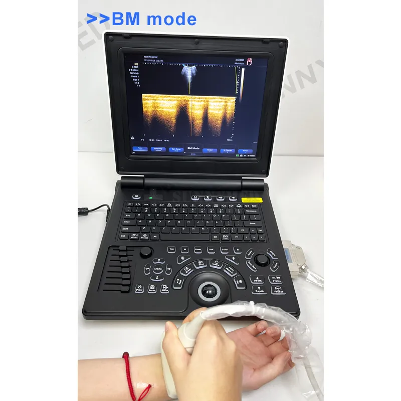 Diagnóstico Doppler 8