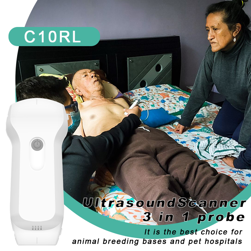 Konted C10rl Escáner de ultrasonido Doppler color inalámbrico de mano con sondas duales 3-in-1