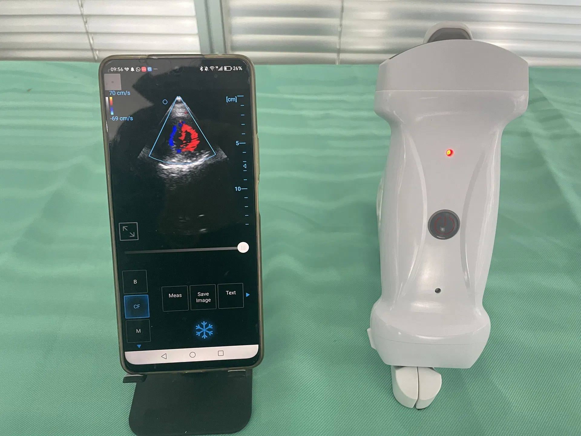 Máquina de ultrasonido portátil a color Doppler