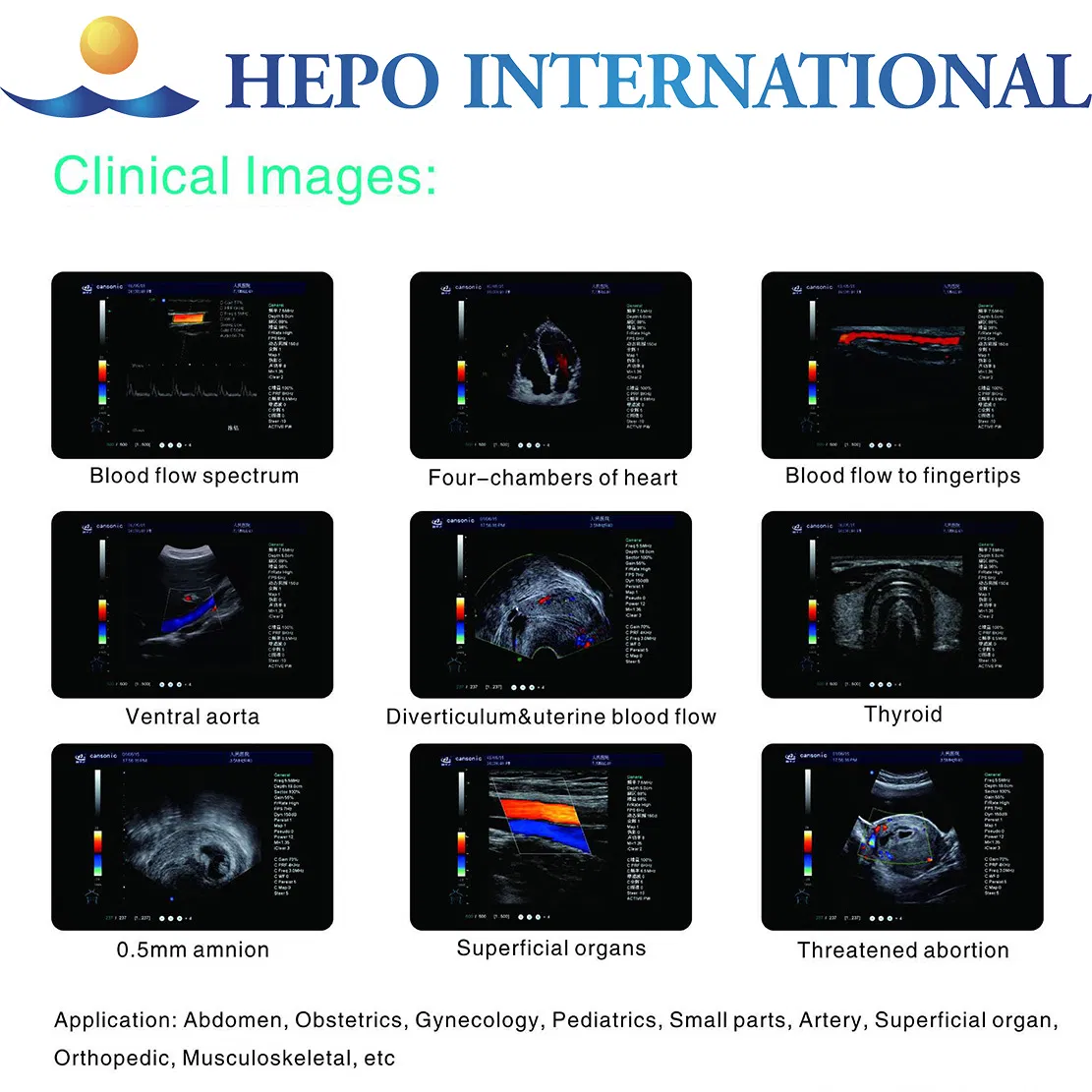 Sistema de Ultrasonido Doppler Color Portátil Cardíaco 4D para Hospital