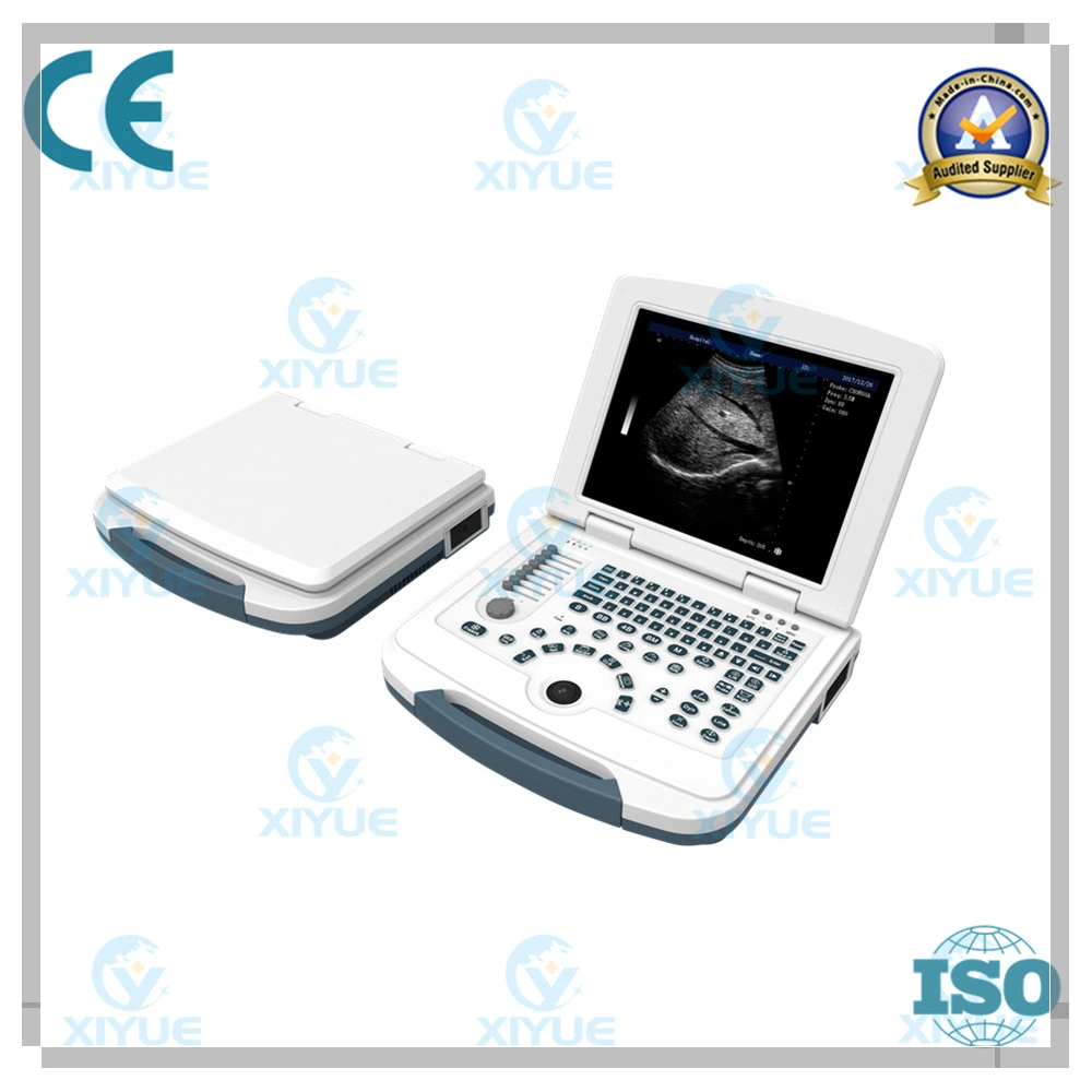 Sistema de Diagnóstico Ultrasonido Digital Completo para Laptop Cy-580