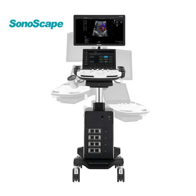 Ultrasonido Doppler P11